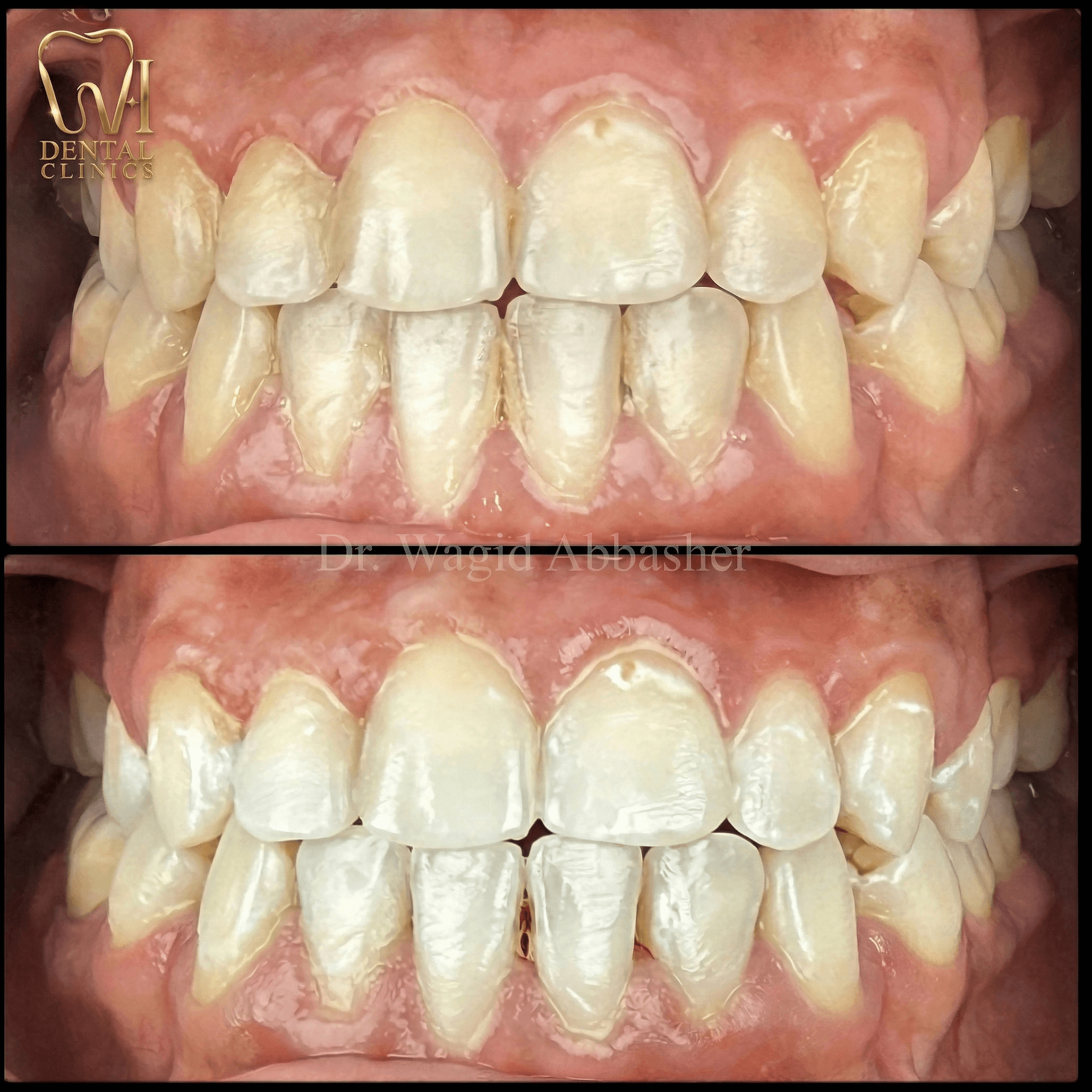 Aesthetic Dentistry before