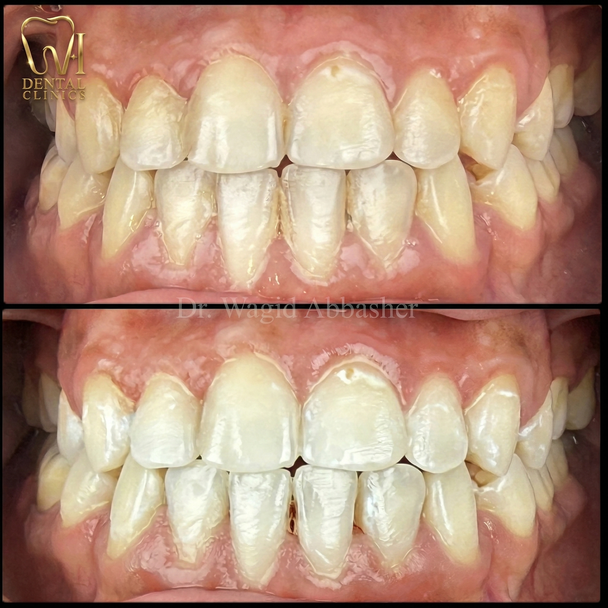 Aesthetic Dentistry before